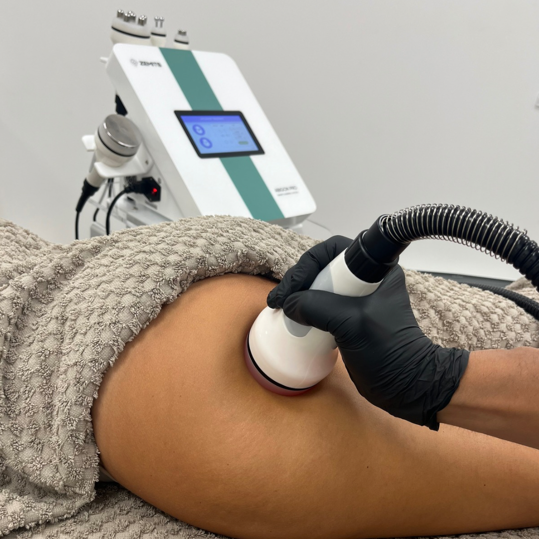 Ultrasound Cavitation RF